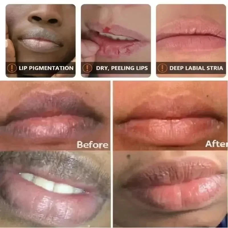 Fast Remove Dark Lip Balm Serum Lighten Melanin Lip Mask Exfoliating Fade Lip Lines Dead Skin Nourishing Repair Lip Care Makeup